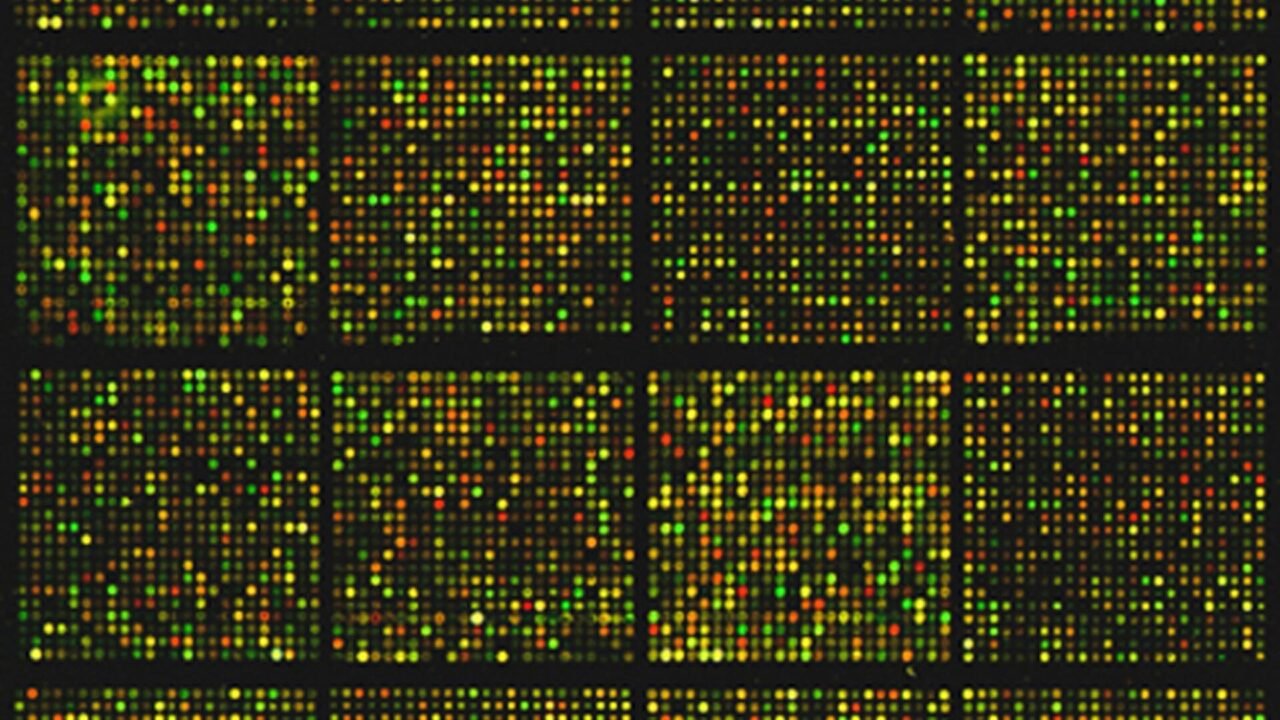 A mouse cDNA microarray gene sequences