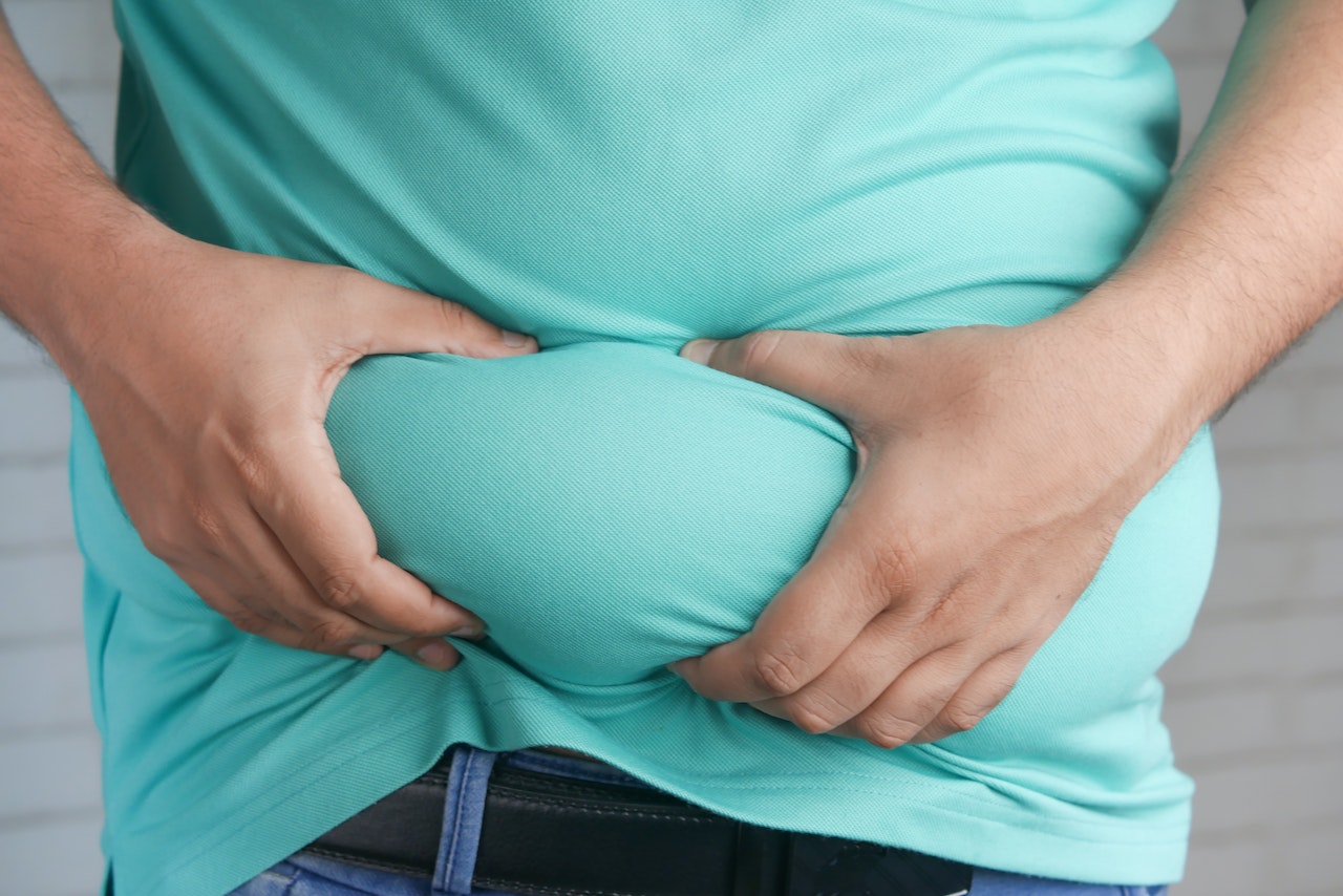 close up of belly of an obese person