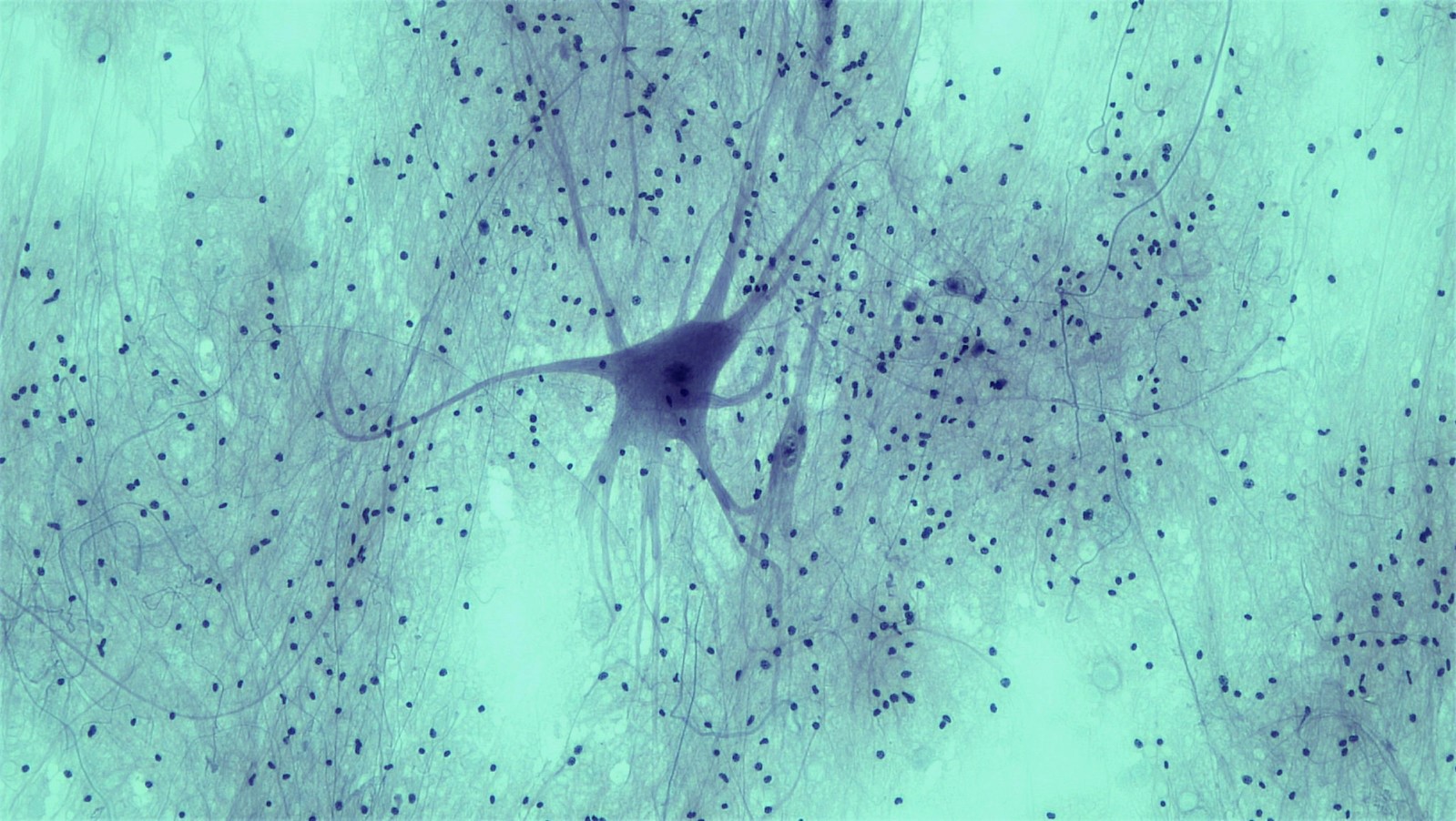 spinal cord neuron cell