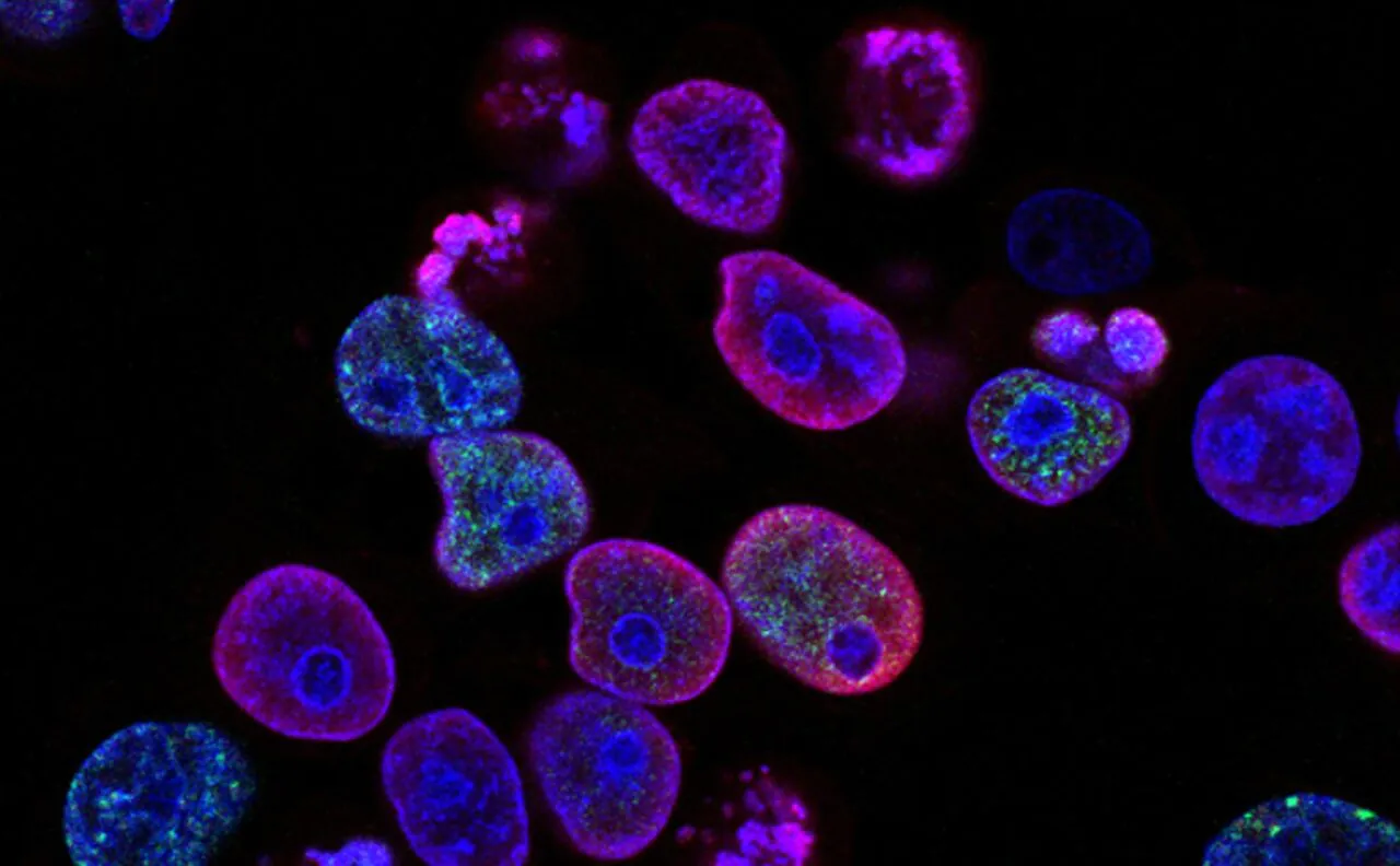 cancer cells